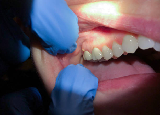 Best Weekend Emergency Dentist in Morgans Point Resort, TX
