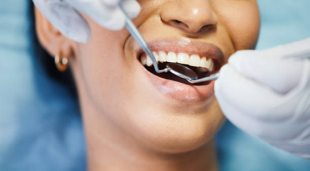 Best Emergency Dentist for Knocked-Out Tooth in Morgans Point Resort, TX